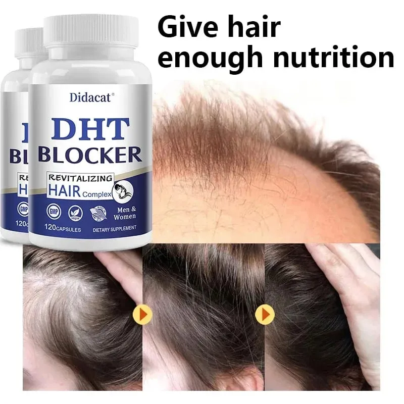 Didacat Advanced DHT Blocker Hair Growth Supplement for Heritary Thinning Hair - για άνδρες και γυναίκες τριχόπτωση