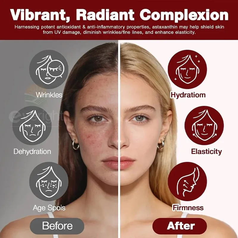 Astaxanthin 24mg – Potent Antioxidant for Skin Eyes & Immune Health – 10-in-1 with Lycopene Grape Seed Vitamin E & Zinc